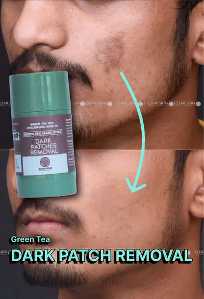 Green Tea Mask - Dark Patch Removal
